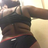 Lưng dày nhiều cuộn mỡ và hút mỡ Smartlipo Lưng dày nhiều cuộn mỡ và hút mỡ Smartlipo