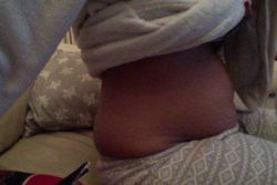 Hút mỡ bằng laser ở vùng quanh bụng có phù hợp không? Tôi 26 tuổi, cao 1m49 và nặng 59 kg