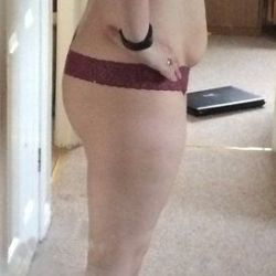 Tôi muốn hút mỡ VASER nhưng có thể không đúng chỉ định. Có cách nào khác ngoài phẫu thuật tạo hình thành bụng không?