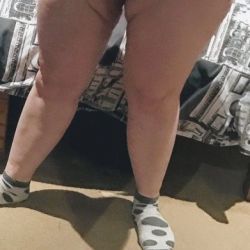 Hút mỡ VASER để lại những nếp nhăn và lằn xấu xí ở chân làm tôi rất thất vọng. Tôi có thể làm gì bây giờ?