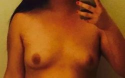 Có thể làm cho vú trở nên căng tròn sau khi bị chảy xệ thành hình ovan không?