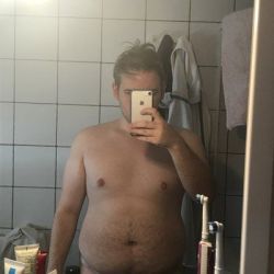 Hút mỡ bằng sóng siêu âm VASER hay phẫu thuật tạo hình bụng tốt cho tôi