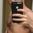 Quy trình nào phù hợp với tôi, liệu hút mỡ có phù hợp không?