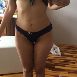 Nên thực hiện hút mỡ siêu âm hay Laser?