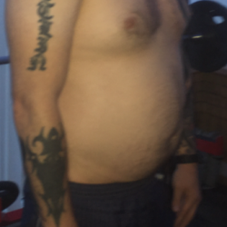 Tôi muốn hút mỡ VASER vì những năm qua tăng rất nhiều cân, nhưng tôi lo là mình không hợp với quy trình này