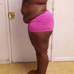 Tôi đang xem xét phẫu thuật thẩm mỹ để tìm lại động lực và hy vọng - liệu có hiệu quả không?