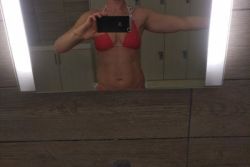 Cách tốt nhất để giảm mỡ cánh tay: hút mỡ VASER, đông hủy mỡ coolsculpting hay phương pháp nào khác?