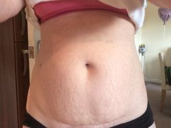 Tìm kiếm lời khuyên về hút mỡ hay tạo hình thành bụng. Phương pháp nào sẽ phù hợp với tôi? Tôi thích hút mỡ Vaser hơn