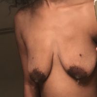 Có thể chỉ treo ngực sa trễ thôi không?