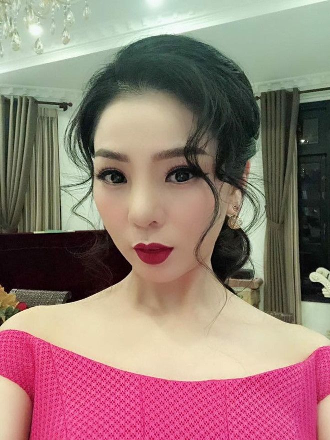 lệ quyên sau tháo sụn