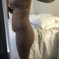 Nên giảm cân hay tăng cân trước khi nâng mông và tạo hình thành bụng?