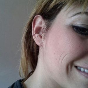 Làm thế nào để xóa nếp nhăn má?