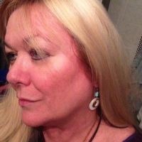 Chi phí mỗi lần tiêm Kybella là bao nhiêu và cần mấy lần tiêm?