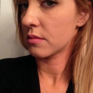 29 tuổi thì có quá sớm để căng da mặt không?