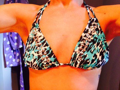 Hành trình nâng cấp vòng một từ size 34B lên size 34DD với túi độn 400cc độ nhô trên trung bình