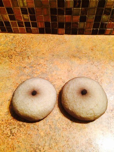 Hành trình nâng ngực bằng túi độn size 350cc của người mẹ 2 con chỉ nặng tròn 41kg