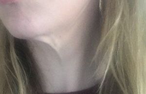 Tôi cần làm gì để cải thiện thừng cổ khi mới 37 tuổi?