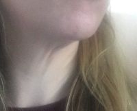 Tôi cần làm gì để cải thiện thừng cổ khi mới 37 tuổi?