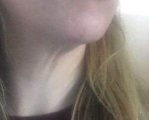 Tôi cần làm gì để cải thiện thừng cổ khi mới 37 tuổi?