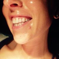 Cách xử lý răng cửa quá to và cười hở lợi