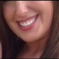 Làm thế nào để khắc phục răng nhỏ và cười hở lợi?