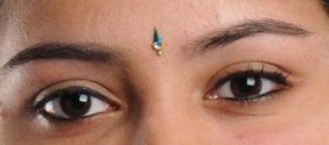 Nên nâng chân mày hay cắt mí để sửa một mắt to hơn mắt còn lại?