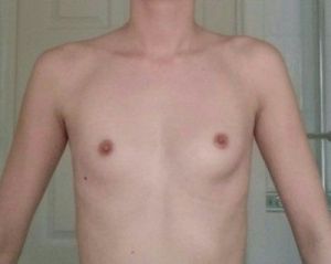 Nên đặt túi độn hình tròn hay hình giọt nước?