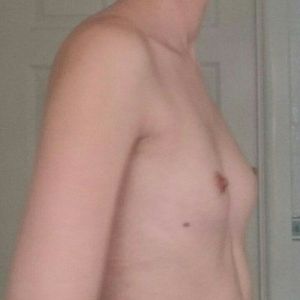 Nên đặt túi độn hình tròn hay hình giọt nước?