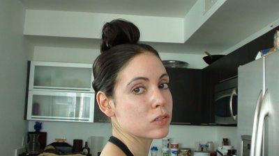 Tự tin sở hữu gương mặt baby đầy đặn với hành trình cấy mỡ tự thân vùng mặt/má và các vùng trũng sâu dưới mắt