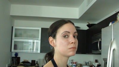 Tự tin sở hữu gương mặt baby đầy đặn với hành trình cấy mỡ tự thân vùng mặt/má và các vùng trũng sâu dưới mắt