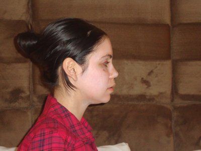 Tự tin sở hữu gương mặt baby đầy đặn với hành trình cấy mỡ tự thân vùng mặt/má và các vùng trũng sâu dưới mắt