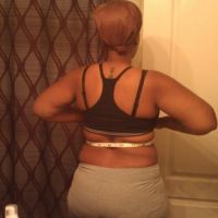 Mỗi lần hút mỡ cần cách nhau bao lâu?