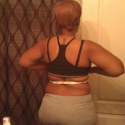 Mỗi lần hút mỡ cần cách nhau bao lâu?