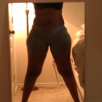 Mỗi lần hút mỡ cần cách nhau bao lâu?