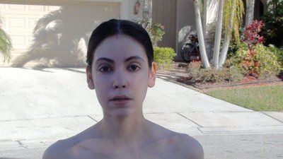 Tự tin sở hữu gương mặt baby đầy đặn với hành trình cấy mỡ tự thân vùng mặt/má và các vùng trũng sâu dưới mắt