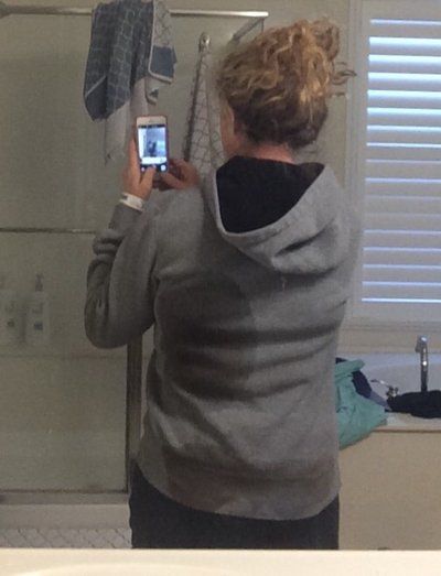 Cùng theo dõi quá trình hút bỡ hai bên hông, sườn và lưng của bà mẹ 46 tuổi