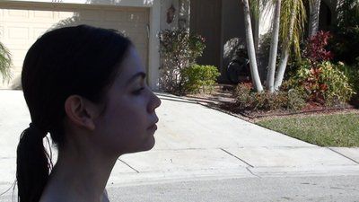 Tự tin sở hữu gương mặt baby đầy đặn với hành trình cấy mỡ tự thân vùng mặt/má và các vùng trũng sâu dưới mắt