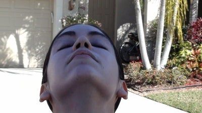 Tự tin sở hữu gương mặt baby đầy đặn với hành trình cấy mỡ tự thân vùng mặt/má và các vùng trũng sâu dưới mắt