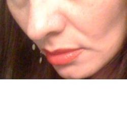 Nên tiêm filler hay điều trị bằng Ultherapy?