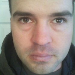 Nên cắt mí dưới qua đường rạch kết mạc hay đường rạch ngoài da?