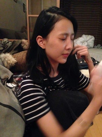 Quá trình cấy mỡ tự thân tạm biệt vẻ già nua của cô người mẫu 27 tuổi