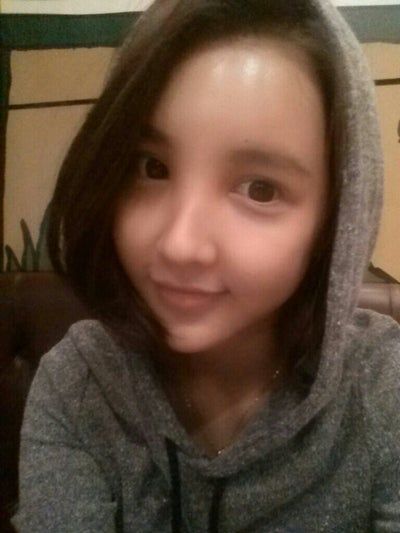 Quá trình cấy mỡ tự thân tạm biệt vẻ già nua của cô người mẫu 27 tuổi