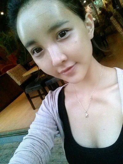 Quá trình cấy mỡ tự thân tạm biệt vẻ già nua của cô người mẫu 27 tuổi