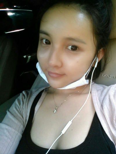 Quá trình cấy mỡ tự thân tạm biệt vẻ già nua của cô người mẫu 27 tuổi