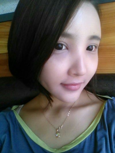 Quá trình cấy mỡ tự thân tạm biệt vẻ già nua của cô người mẫu 27 tuổi