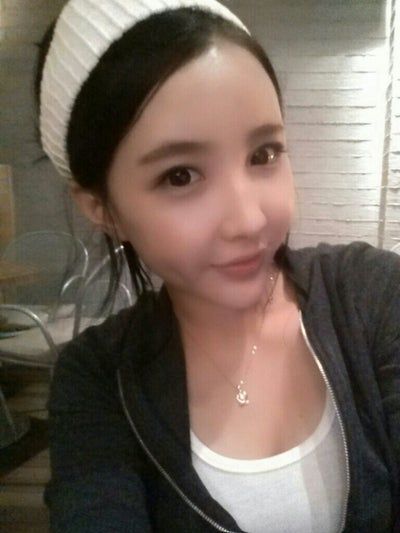 Quá trình cấy mỡ tự thân tạm biệt vẻ già nua của cô người mẫu 27 tuổi