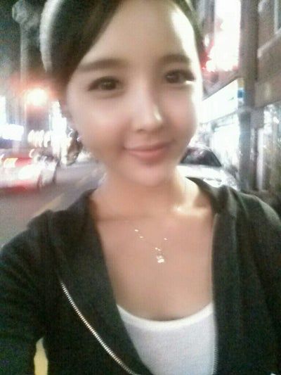 Quá trình cấy mỡ tự thân tạm biệt vẻ già nua của cô người mẫu 27 tuổi