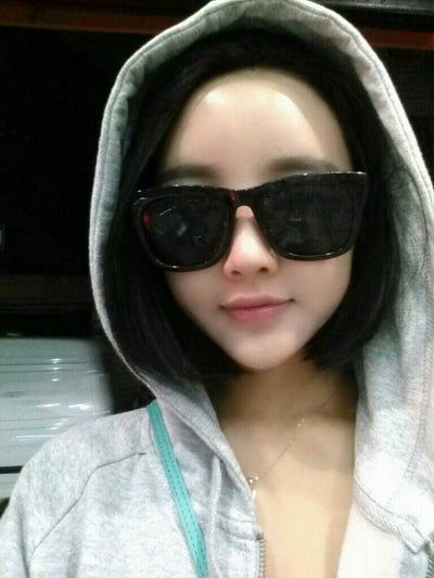 Quá trình cấy mỡ tự thân tạm biệt vẻ già nua của cô người mẫu 27 tuổi