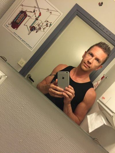 Hành trình 2 lần cấy mỡ tự thân để vĩnh biệt khuôn mặt hóp già nua, tự tin sở hữu gương mặt đường nét, nam tính