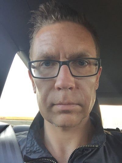 Hành trình 2 lần cấy mỡ tự thân để vĩnh biệt khuôn mặt hóp già nua, tự tin sở hữu gương mặt đường nét, nam tính